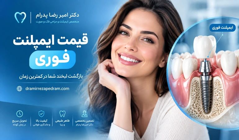 قیمت ایمپلنت فوری
